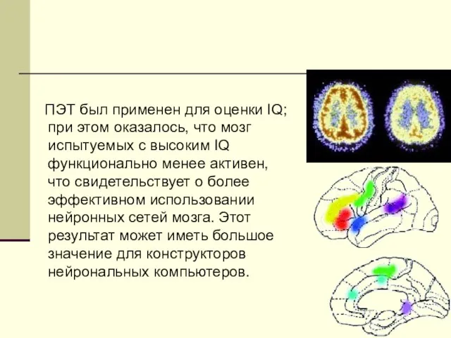 ПЭТ был применен для оценки IQ; при этом оказалось, что мозг