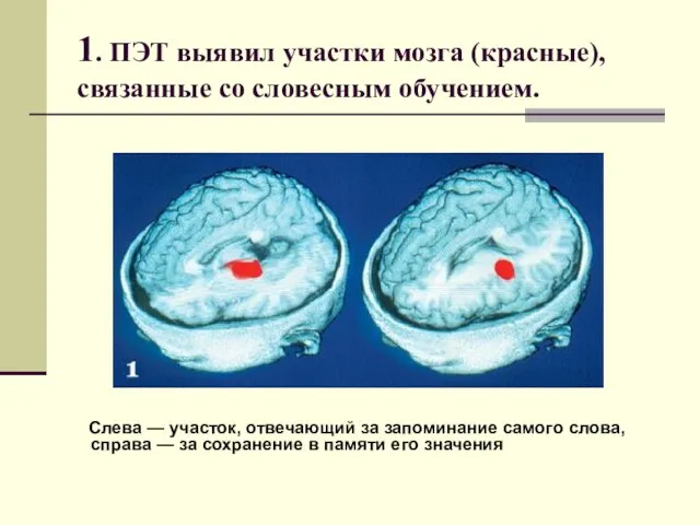 1. ПЭТ выявил участки мозга (красные), связанные со словесным обучением. Слева