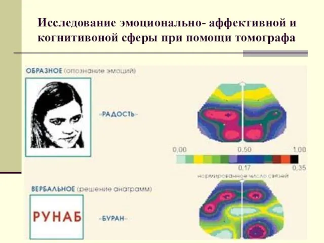 Исследование эмоционально- аффективной и когнитивоной сферы при помощи томографа