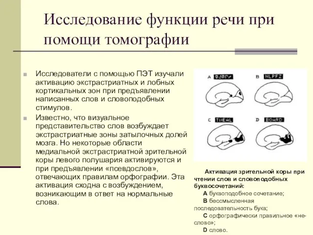 Исследование функции речи при помощи томографии Исследователи с помощью ПЭТ изучали