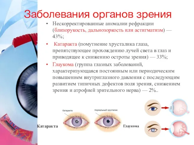 Заболевания органов зрения Нескорректированные аномалии рефракции (близорукость, дальнозоркость или астигматизм) —