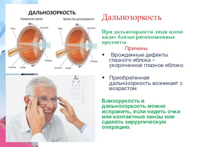 Дальнозоркость При дальнозоркости люди плохо видят близко расположенные предметы Причины Врожденные