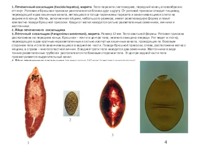 1. Печеночный сосальщик (Fasciola hepatica), марита. Тело паразита листовидное, передний конец