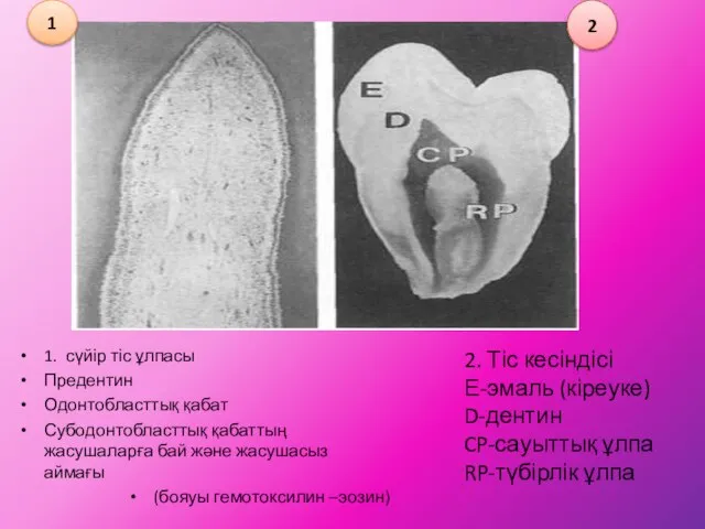 1. сүйір тіс ұлпасы Предентин Одонтобласттық қабат Субодонтобласттық қабаттың жасушаларға бай