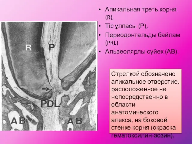 Апикальная треть корня (R), Тіс ұлпасы (Р), Периодонтальды байлам (PRL) Альвеолярлы