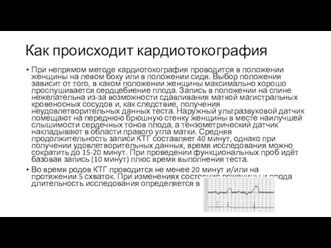 Как происходит кардиотокография При непрямом методе кардиотокография проводится в положении женщины