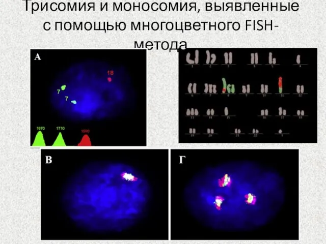 Трисомия и моносомия, выявленные с помощью многоцветного FISH-метода