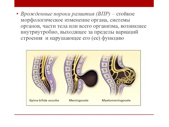 Врожденные пороки развития (ВПР) – стойкое морфологическое изменение органа, системы органов,