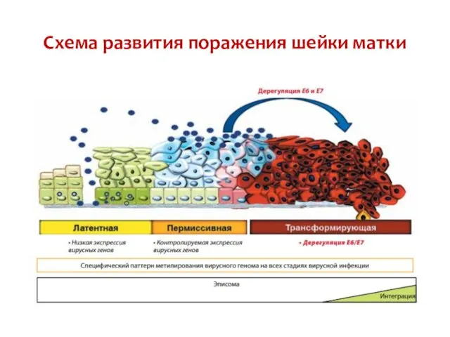 Схема развития поражения шейки матки