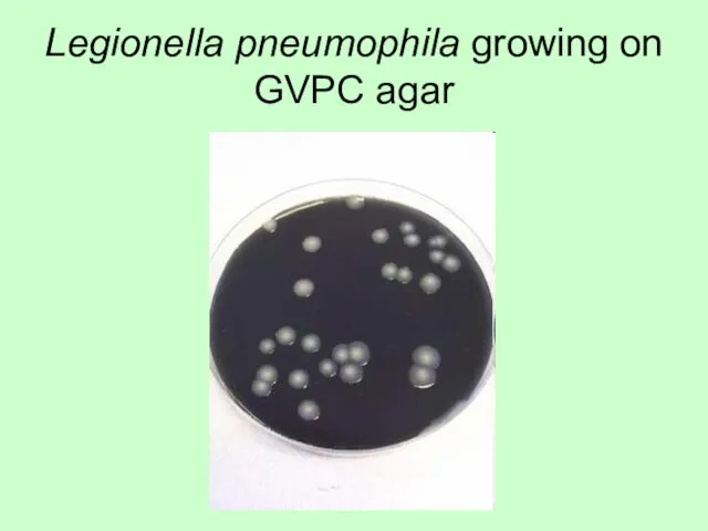 Legionella pneumophila growing on GVPC agar