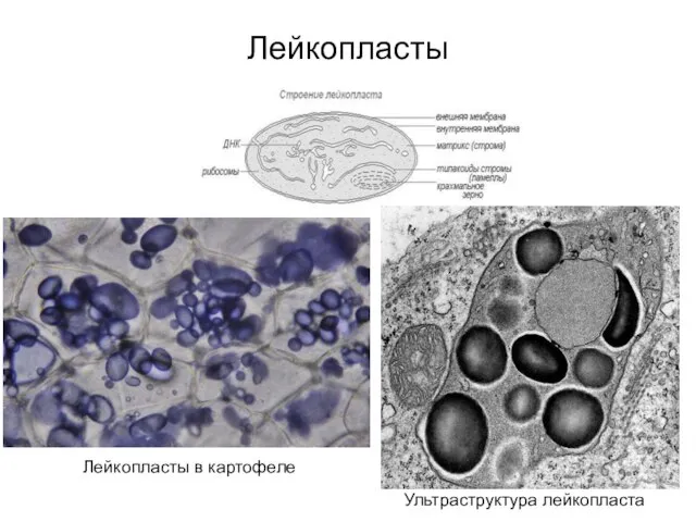 Лейкопласты Лейкопласты в картофеле Ультраструктура лейкопласта