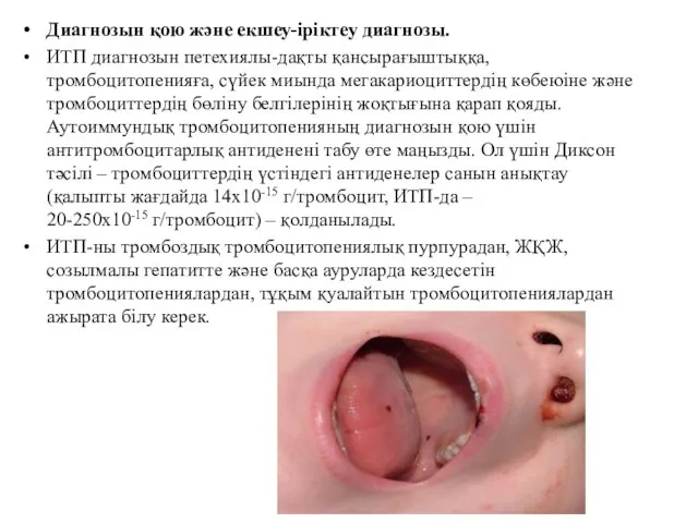 Диагнозын қою және екшеу-іріктеу диагнозы. ИТП диагнозын петехиялы-дақты қансырағыштыққа, тромбоцитопенияға, сүйек