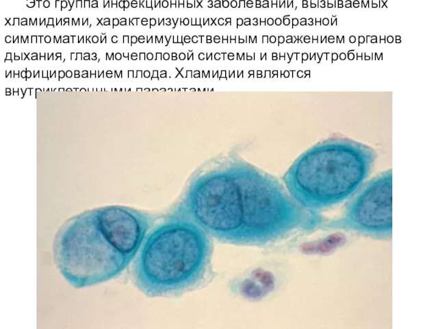 Это группа инфекционных заболеваний, вызываемых хламидиями, характеризующихся разнообразной симптоматикой с преимущественным