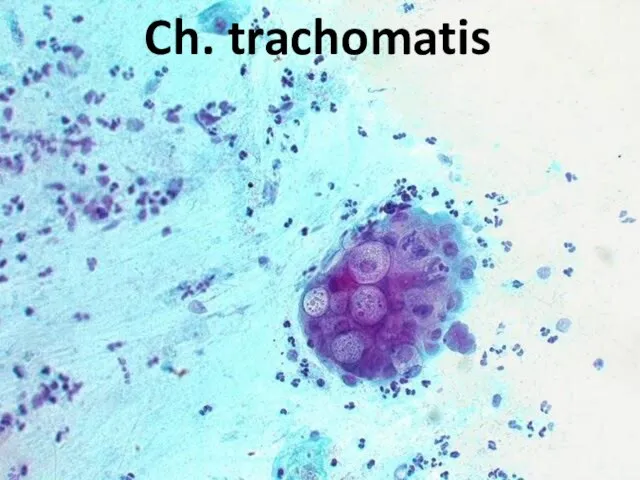 Ch. trachomatis