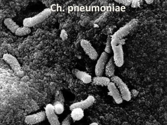 Ch. pneumoniae