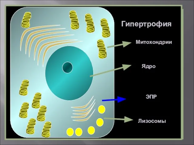 Hypertrophy