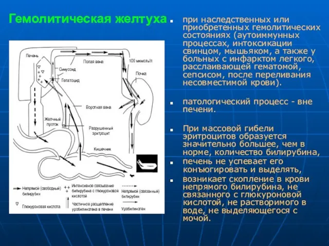 Гемолитическая желтуха при наследственных или приобретенных гемолитических состояниях (аутоиммунных процессах, интоксикации