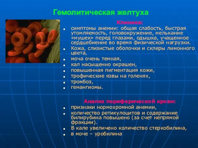 Гемолитическая желтуха Клиника: симптомы анемии: общая слабость, быстрая утомляемость, головокружение, мелькание