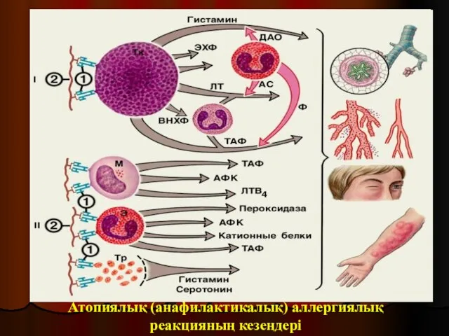 Атопиялық (анафилактикалық) аллергиялық реакцияның кезеңдері