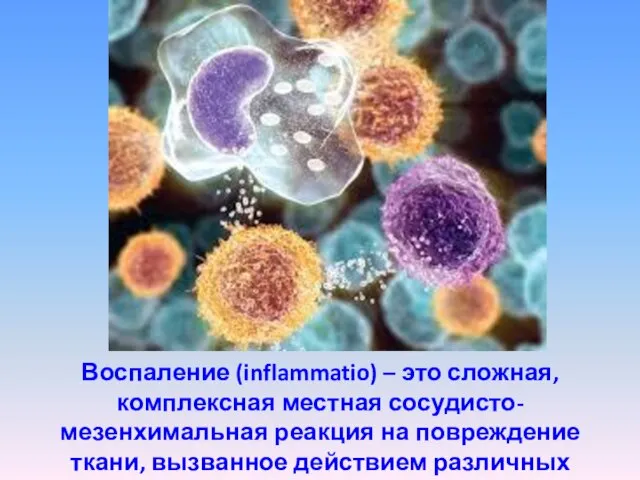 Воспаление (inflammatio) – это сложная, комплексная местная сосудисто-мезенхимальная реакция на повреждение ткани, вызванное действием различных агентов.