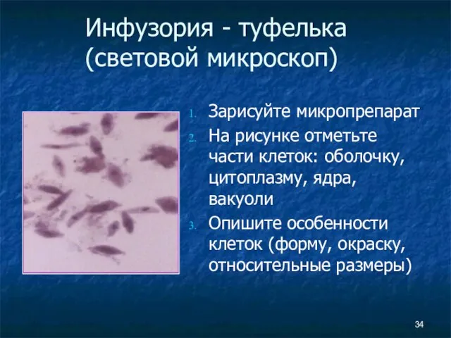 Инфузория - туфелька (световой микроскоп) Зарисуйте микропрепарат На рисунке отметьте части