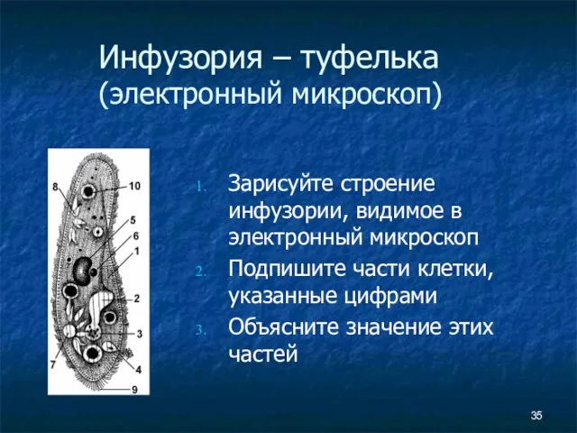 Инфузория – туфелька (электронный микроскоп) Зарисуйте строение инфузории, видимое в электронный