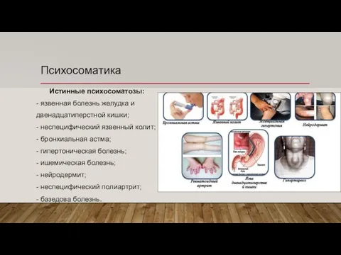 Психосоматика Истинные психосоматозы: - язвенная болезнь желудка и двенадцатиперстной кишки; -