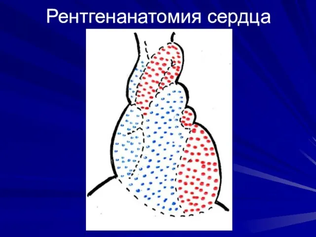 Рентгенанатомия сердца