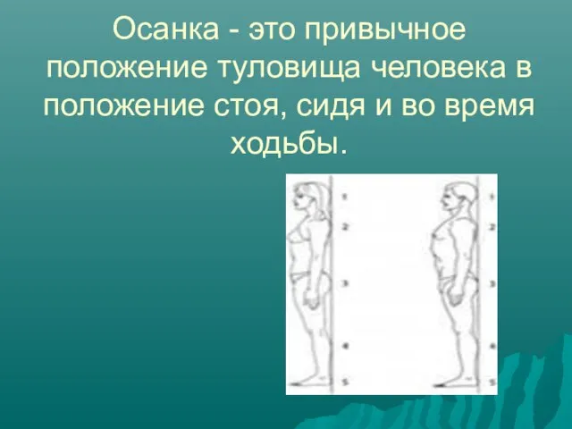 Осанка - это привычное положение туловища человека в положение стоя, сидя и во время ходьбы.