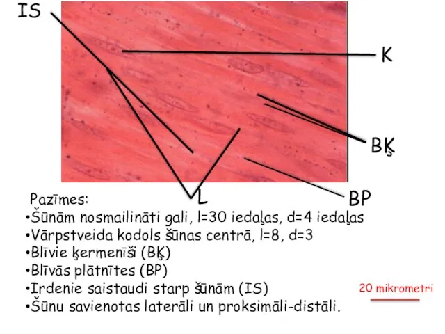 Pazīmes: Šūnām nosmailināti gali, l=30 iedaļas, d=4 iedaļas Vārpstveida kodols šūnas