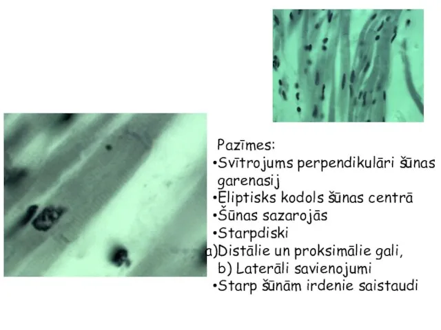 Pazīmes: Svītrojums perpendikulāri šūnas garenasij Eliptisks kodols šūnas centrā Šūnas sazarojās