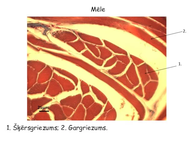 Mēle 1. 1. Šķērsgriezums; 2. Gargriezums. 25µm 2.