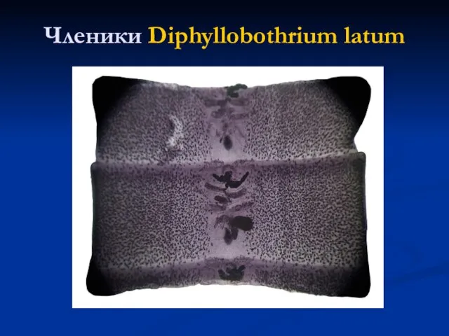 Членики Diphyllobothrium latum