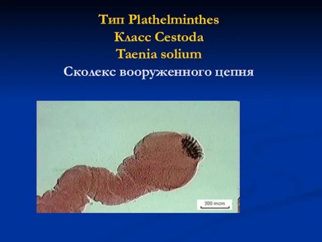 Тип Plathelminthes Класс Cestoda Taenia solium Сколекс вооруженного цепня