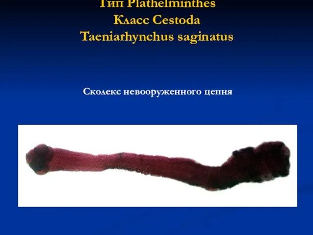 Тип Plathelminthes Класс Cestoda Taeniarhynchus saginatus Сколекс невооруженного цепня