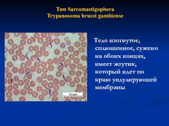 Тело изогнутое, сплющенное, сужено на обоих концах, имеет жгутик, который идет