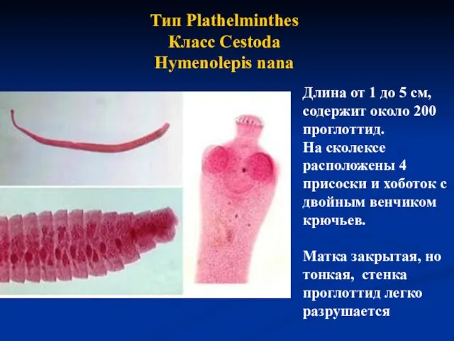 Длина от 1 до 5 см, содержит около 200 проглоттид. На
