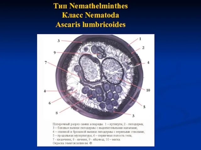 Тип Nemathelminthes Класс Nematoda Ascaris lumbricoides