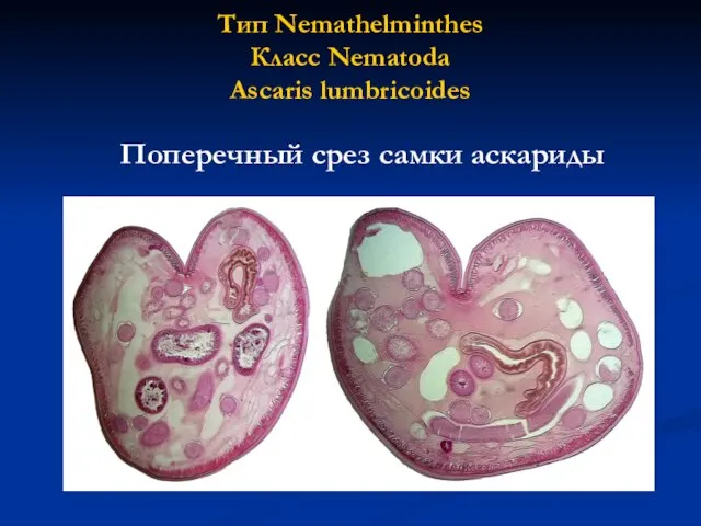 Тип Nemathelminthes Класс Nematoda Ascaris lumbricoides Поперечный срез самки аскариды