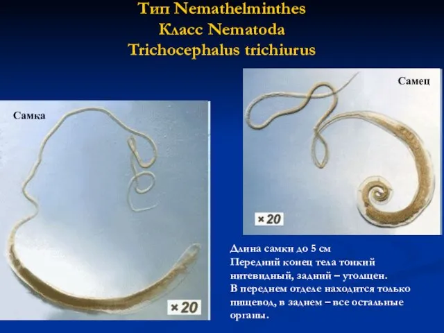 Тип Nemathelminthes Класс Nematoda Trichocephalus trichiurus Длина самки до 5 см