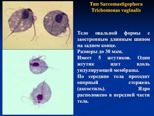 Тип Sarcomastigophora Trichomonas vaginalis Тело овальной формы с заостренным длинным шипом