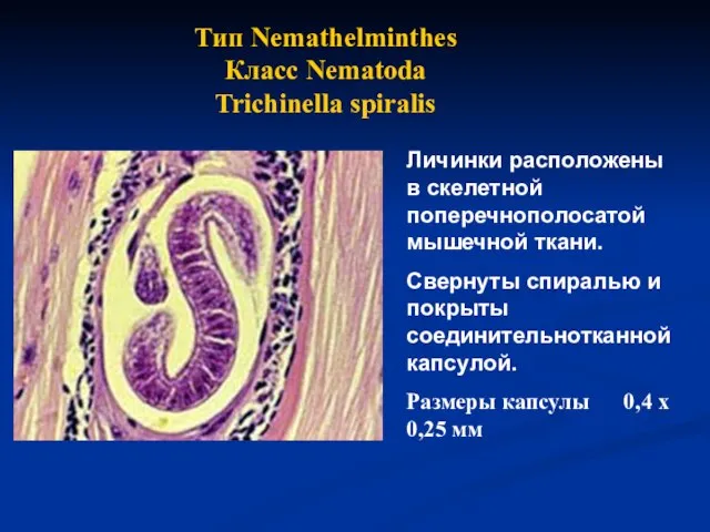 Тип Nemathelminthes Класс Nematoda Trichinella spiralis Личинки расположены в скелетной поперечнополосатой