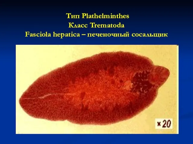 Тип Plathelminthes Класс Trematoda Fasciola hepatica – печеночный сосальщик