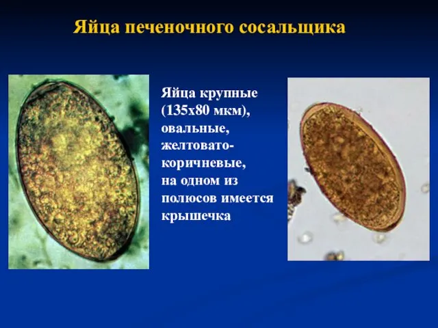 Яйца печеночного сосальщика Яйца крупные (135х80 мкм), овальные, желтовато-коричневые, на одном из полюсов имеется крышечка