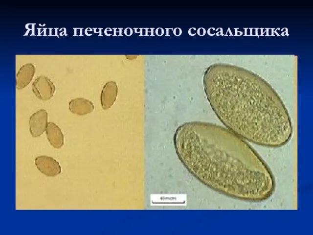 Яйца печеночного сосальщика