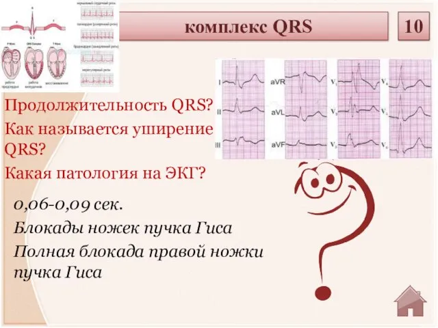 0,06-0,09 сек. Блокады ножек пучка Гиса Полная блокада правой ножки пучка