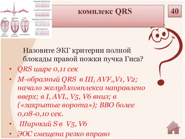 QRS шире 0,11 сек М-образный QRS в III, AVF,,V1, V2; начало