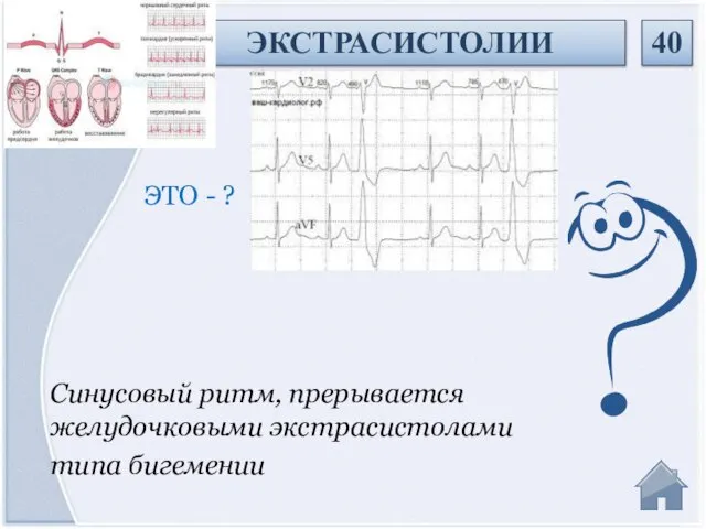 Синусовый ритм, прерывается желудочковыми экстрасистолами типа бигемении ЭТО - ? ЭКСТРАСИСТОЛИИ 40