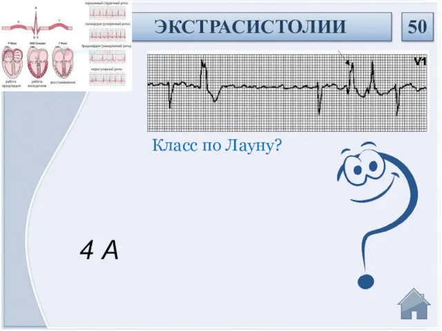 4 А Класс по Лауну? ЭКСТРАСИСТОЛИИ 50