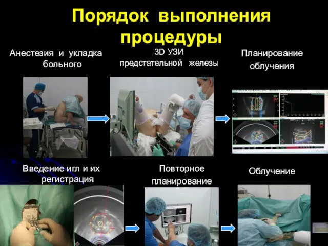 Порядок выполнения процедуры 3D УЗИ предстательной железы Планирование облучения Введение игл